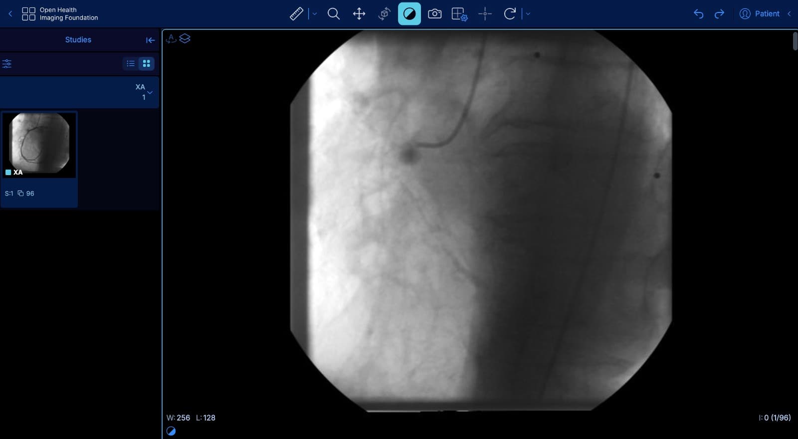 RadView diagnostic viewer